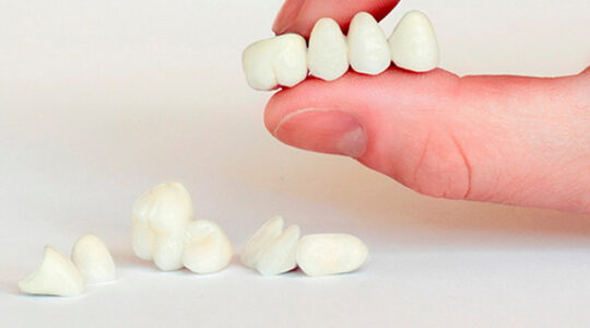 Як ставлять коронку на зуб?